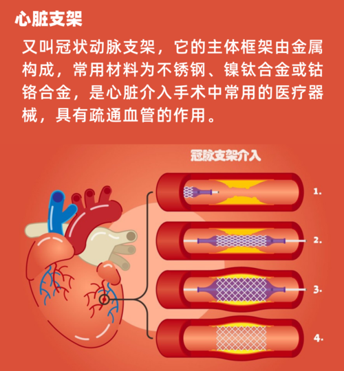 心脏支架什么品牌的最好