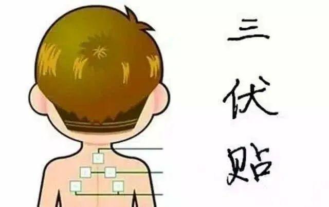 三伏贴大概需要多少钱？