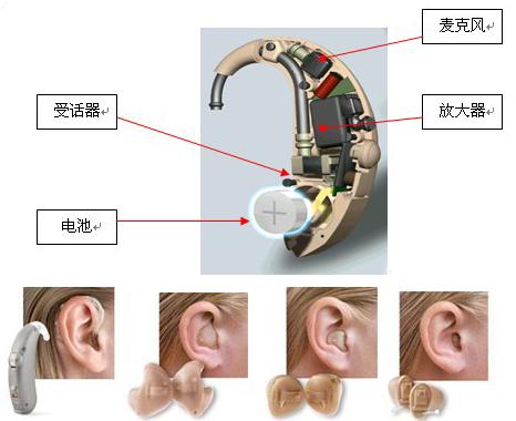 什么是助听器