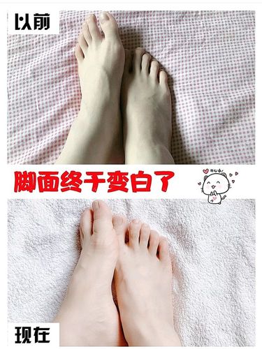 怎么可以美白脚？