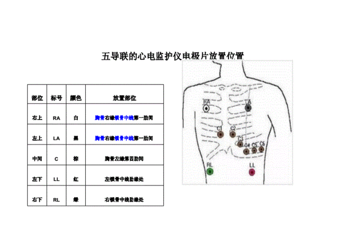 心电图电极片贴放位置？