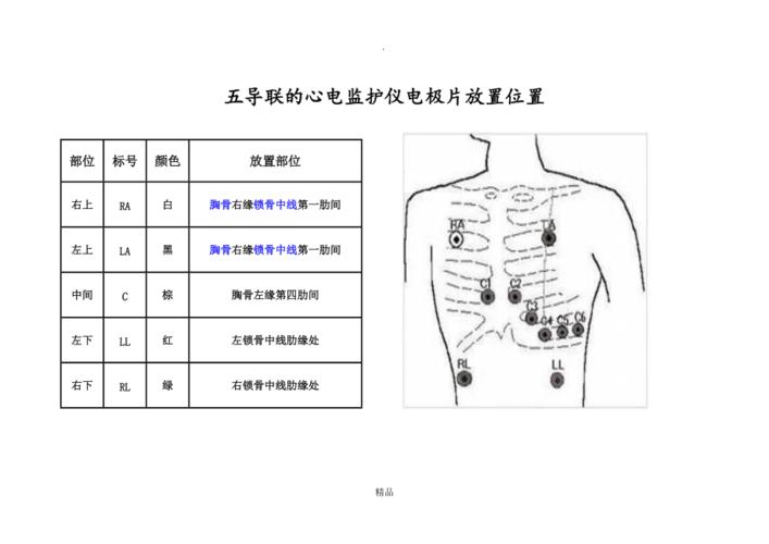 请教心电监护电极片的安放位置